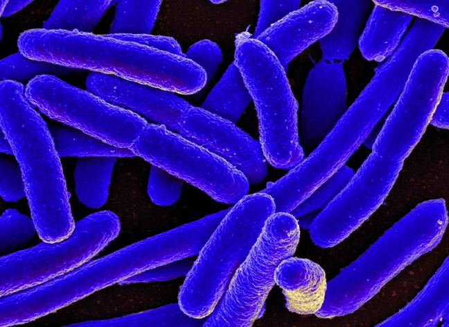 E. coli very often causes the development of cystitis in women